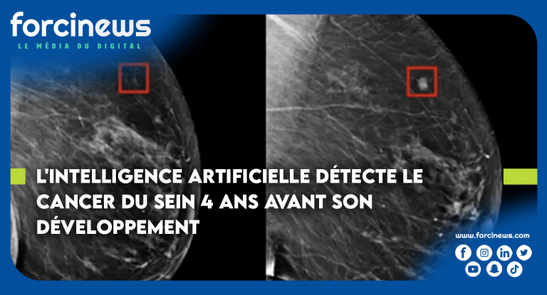 L Intelligence Artificielle D Tecte Le Cancer Du Sein Ans Avant Son D Veloppement Forcinews